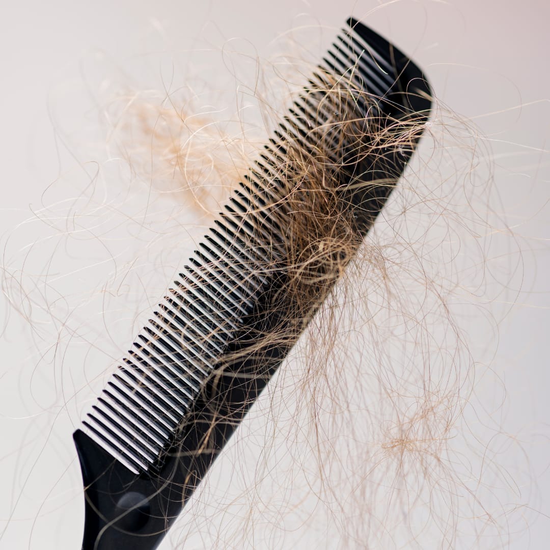 hair extensions cause traction alopecia which causes hair loss shown in a comb